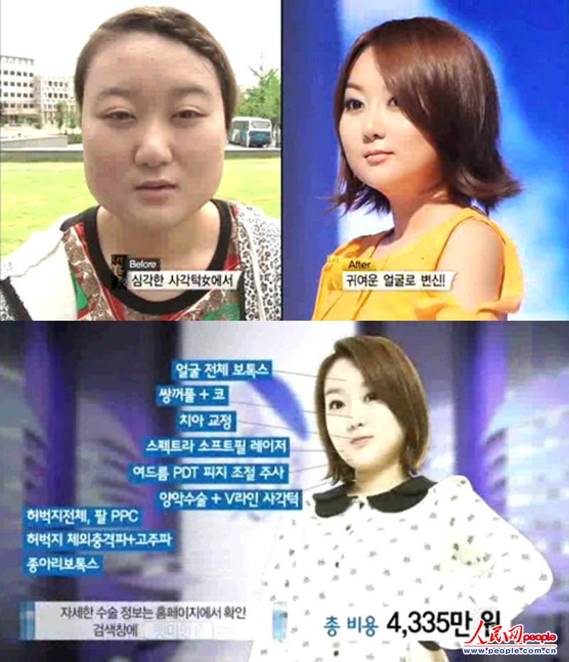 英媒:<em>韩国整容</em>成风致首尔街头<em>姐妹</em>成群-<em>韩国</em>