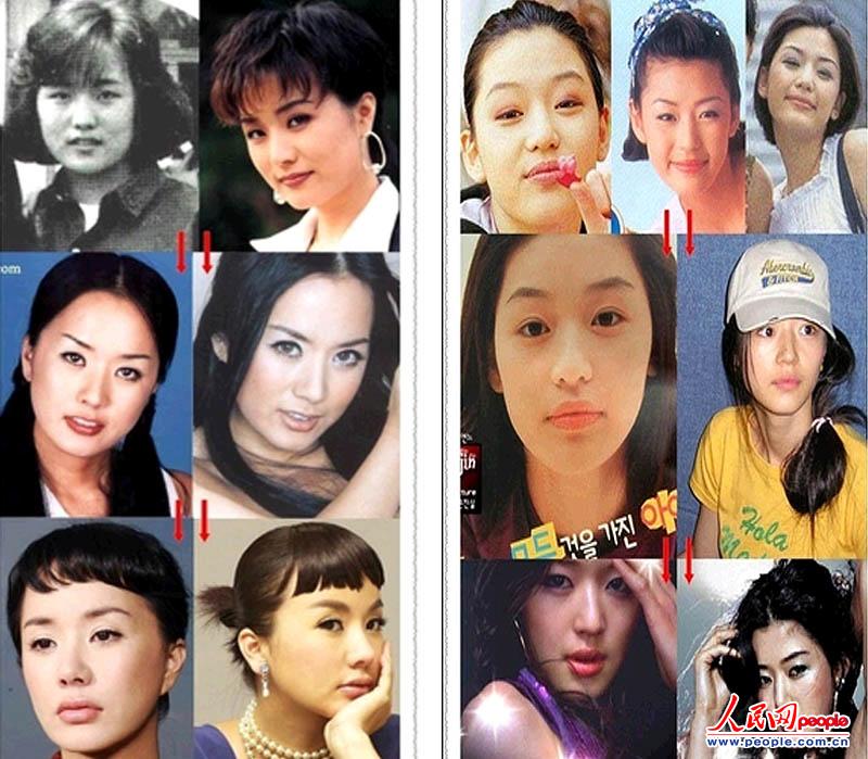 英媒:<em>韩国整容</em>成风致首尔街头<em>姐妹</em>成群