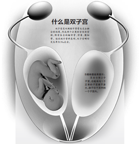 怀孕6个月的准妈妈有两个子宫羊水破了后才发现 洞头新闻网